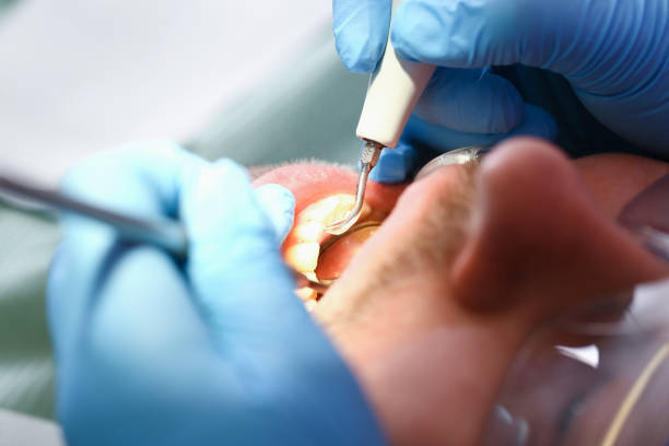 Best Emergency Root Canal Treatment in Harrisburg, OR