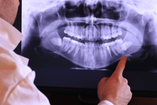 Best Emergency Gum Treatment in Harrisburg, OR